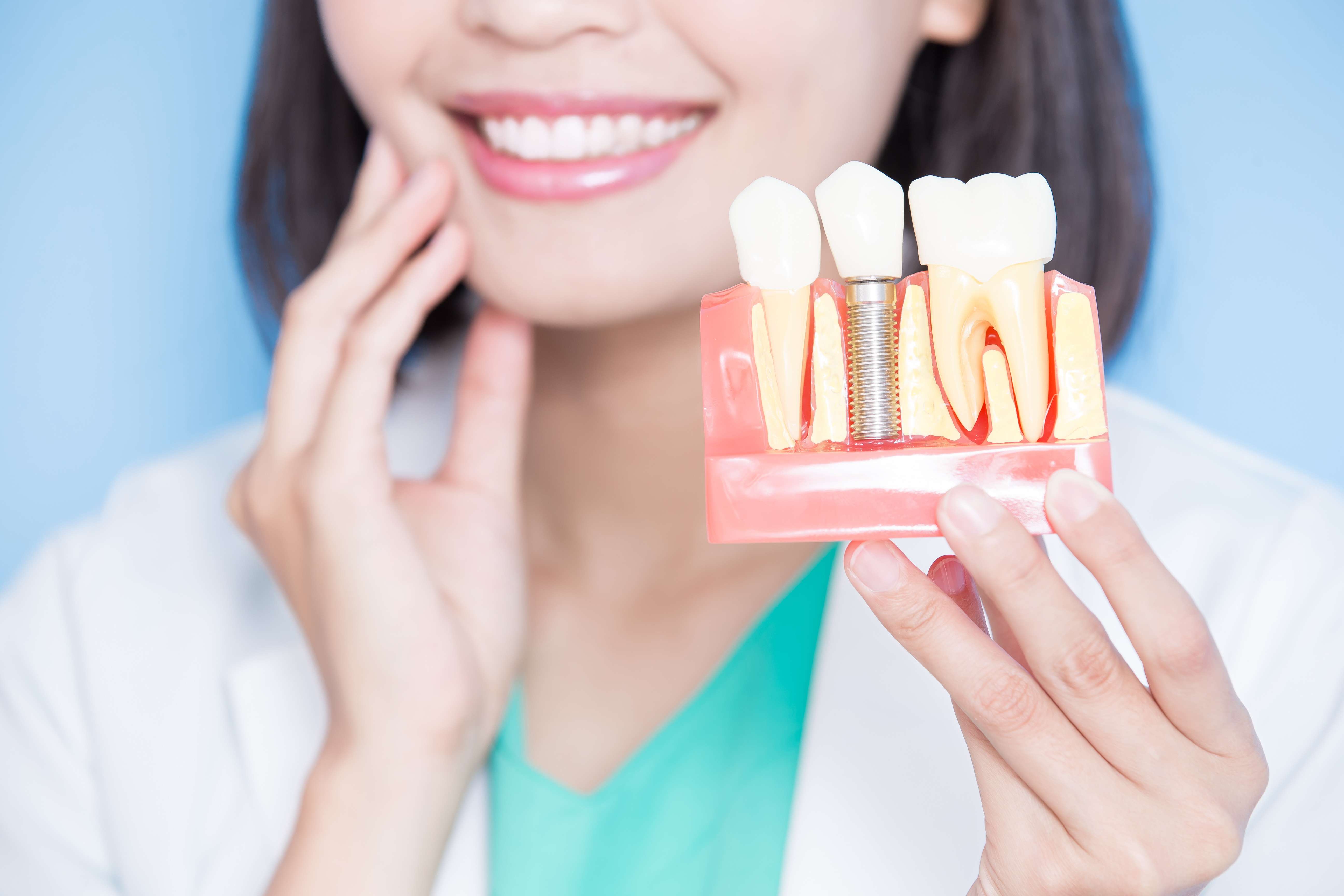 Dental Implants San Antonio