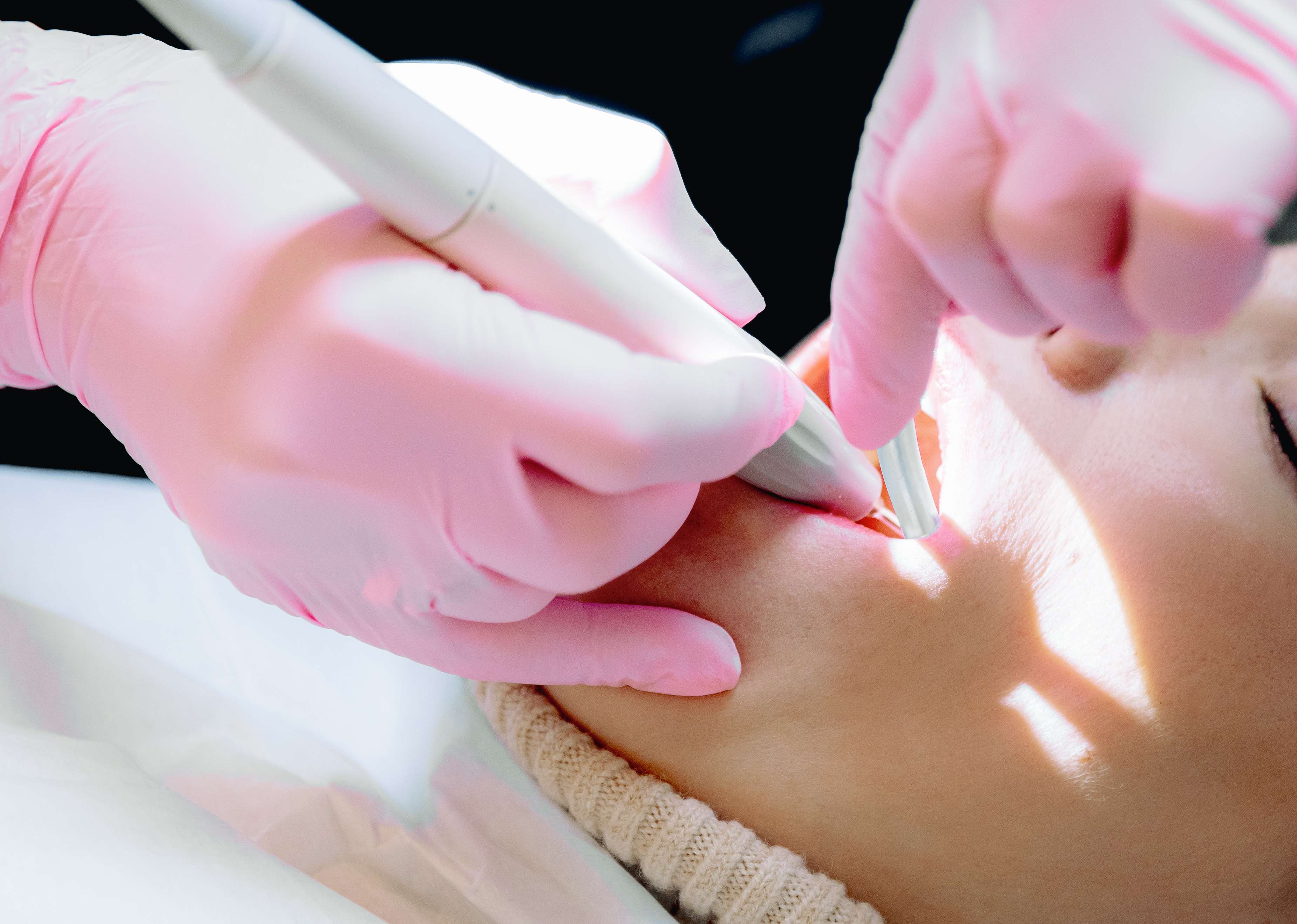 Laser Gum Care San Antonio